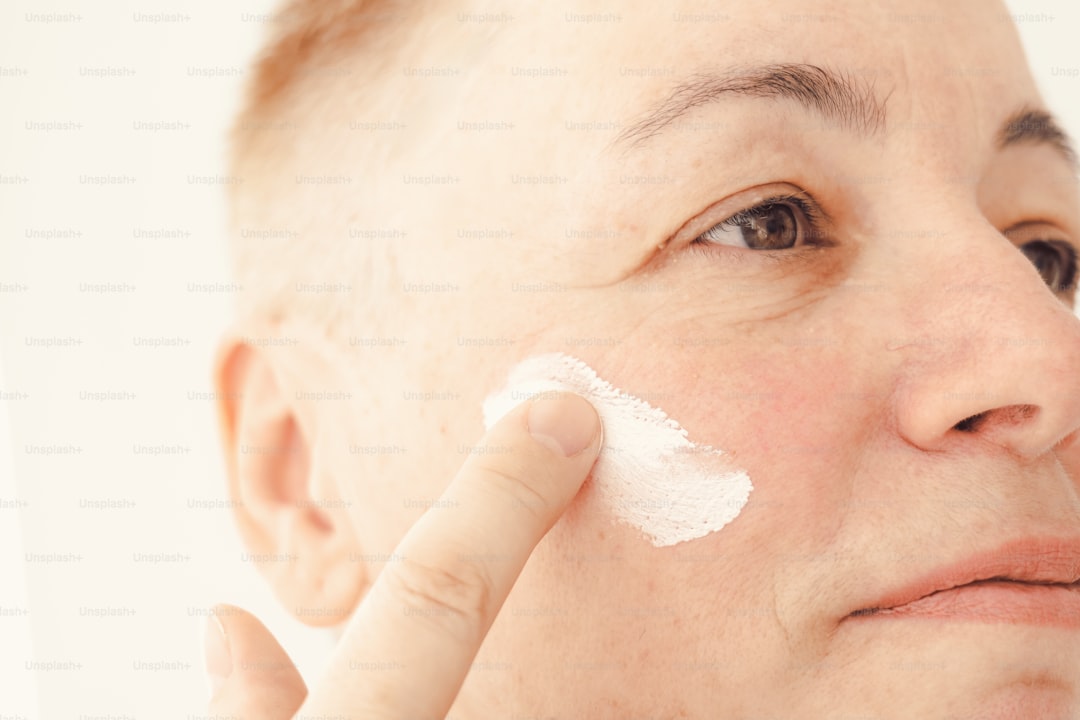 주사피부염 지루성피부염 안전한 크림 선택 가이드